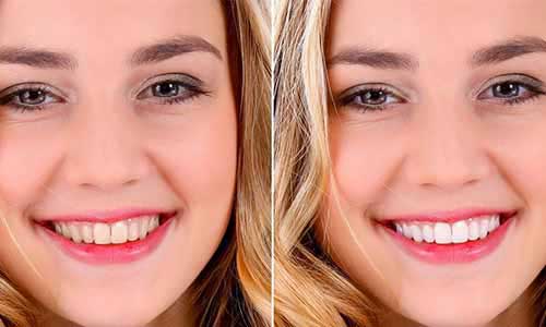 Best ERP Software Provider in Salalah Oman